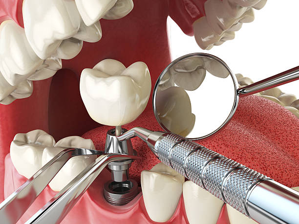 Best Emergency Orthodontic Repairs in Elgin, IL